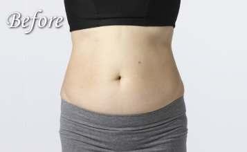 スリムボディー ビフォー