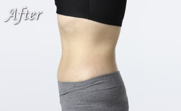 スリムボディー アフター